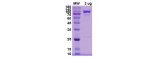 Human PAD4 arginine deiminase type-4 Recombinant Protein