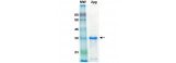 Lipase Protein/ Propionibacterium Acnes LIPASE Recombinant Protein